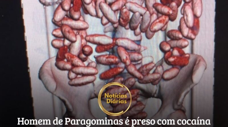 No Aeroporto Internacional do Recife, um paraense de Paragominas e uma mulher de Fortaleza foram presos em flagrante ao tentar embarcar para Lisboa com 214 cápsulas de cocaína no estômago